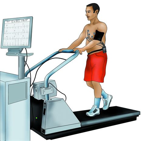 how hard is treadmill stress test|stress test time on treadmill.